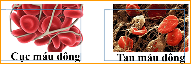 Nattokinase làm tan và phòng ngừa sự hình thành các cục máu đông